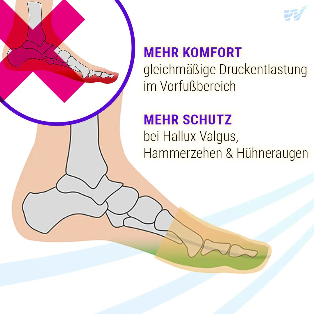 Zehenkappen Supersoft – Schutz und Entlastung bei Hallux Valgus, Hammerzehen und Hühneraugen